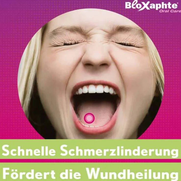 BloXaphte® Oral Care Mundspray bei Aphthen und Verletzungen im Mund, 20 ml
