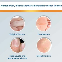 EndWarts® CLASSIC Lösung, 3 ml