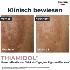 Eucerin Anti-Pigment Teint perfektionierendes Serum, 30 ml