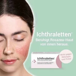 Ichthraletten® 200 mg Tabletten bei Rosazea, 84 St