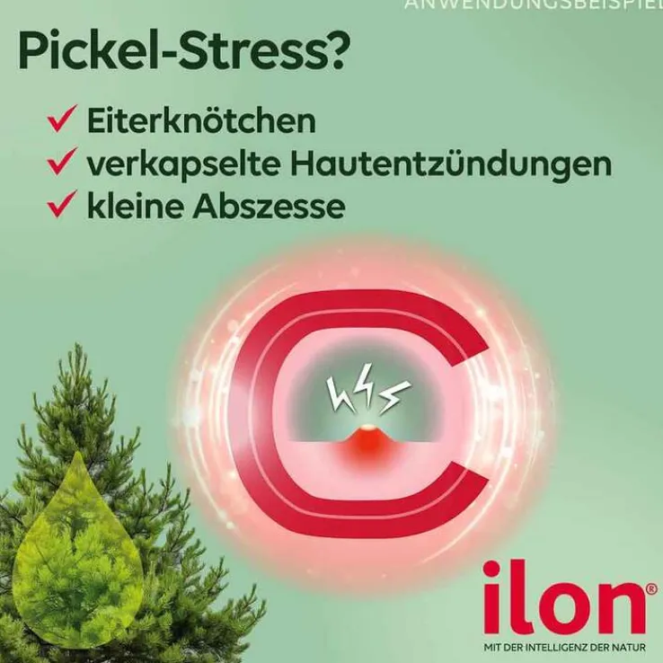 ilon® Salbe classic, 50 g