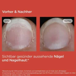 ISDIN Si-Nails Nagelhärter Stift, 2.5 ml