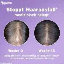 Regaine Frauen Schaum 50 mg/g, 2X60 g