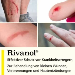 Rivanol 1,0 g Pulver, 20 St