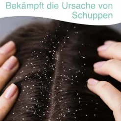 Stieprox Shampoo, 100 ml