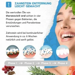 Theranovis oral Zahnstein Spray, 65 ml