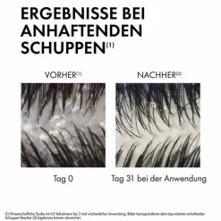 Vichy Dercos Anti-Schuppen Shampoo trockene Kopfhaut, 390 ml