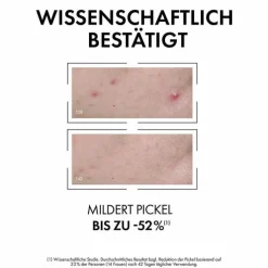 Vichy Normaderm Anti-Unreinheiten Serum, 30 ml